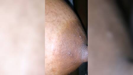 Penis Pump Treatment Part 02