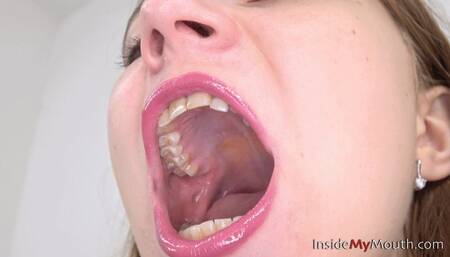 Inside My Mouth - Lola - mouth tour and dental check-up (MOBILE quality)