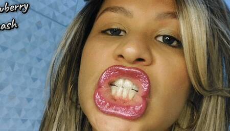 Mouth tour 3 blowing kisses, permanent retainer, lip gloss