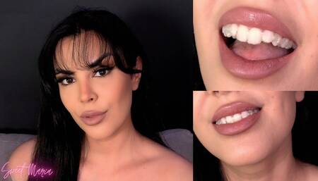 Mouth tour with my aligners! Week 4 ~ Sweet Maria