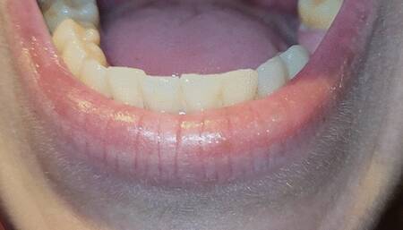 Darkside mouth exploration - best view