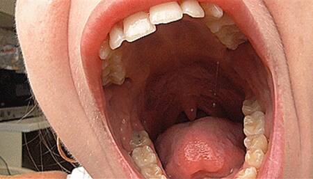 Yawning with a big wide mouth and big teeth! MP4