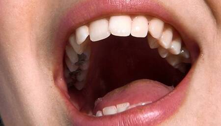 Janina - Face and Open Mouth HD-720