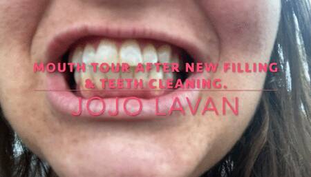 Mouth Tour after first DENTAL CLEANING IN YEARS & NEW FILING