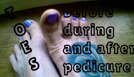 Lady Angela hand held toes before during and after a pedicure