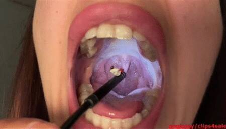 Oral inspection, DEVOURE swallow him
