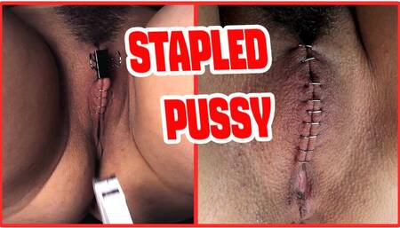 Sadistic doctor closes and staples her patient's pussy