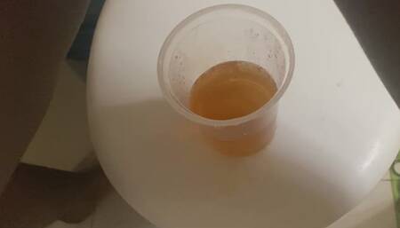 Pee in a cup for you