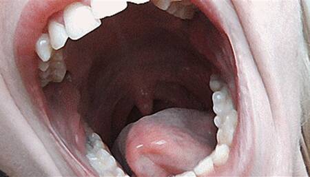 Yawning with a big deep mouth! MP4