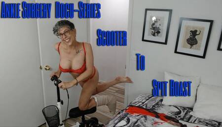 Ankle Surgery Docu-Series Scooter To Spit Roast