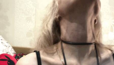 Inflatable balloons and veins