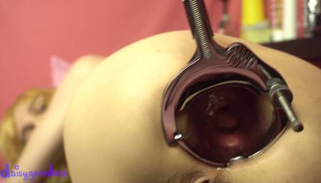 Xo Speculum
