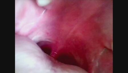 Endoscope of my Mouth