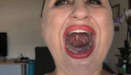 Finger on uvula ORDER a