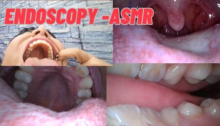 Vore endoscopy -ASMR