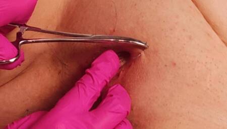 Lower Lips Shut, Upper Lips Scream - Sammy's Pussy Sewn Shut