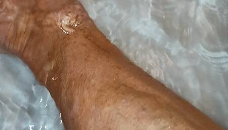 In the tub and muscular calves after cast was removed