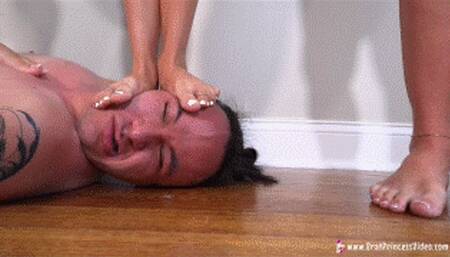 BP – Severe Head Trample