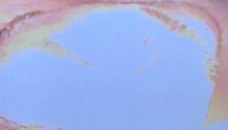 Face and stomach get crushed