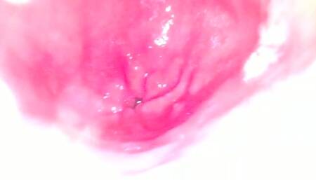 Bailey's Stomach RAW FOOTAGE