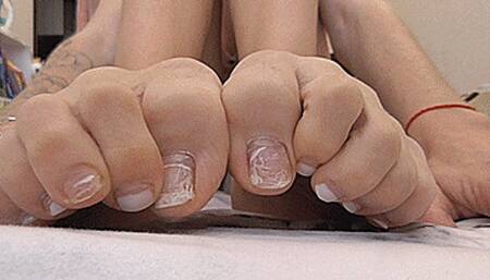Terrible scabby toes! MP4