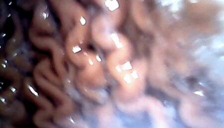 whole hotodogs in stomach