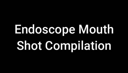 Endoscope Mouth Shot Compilation