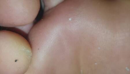 Crushed under Giant Sole