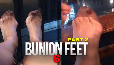 Fetish208 - Foot Fantasies, Bunion Feet 6, Part 2