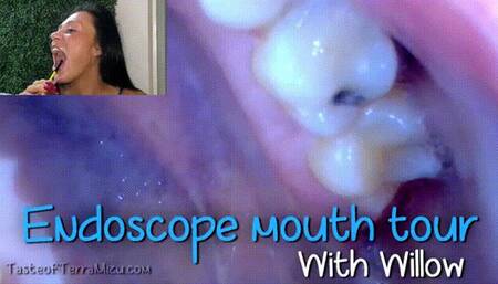Endoscope Mouth Tour - Willow Lansky - HD 720 WMV