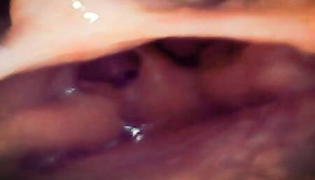 A Journey into the Depths: Exploring My Gut with PillCam, Through Sounds and Images of a Hidden World 4K