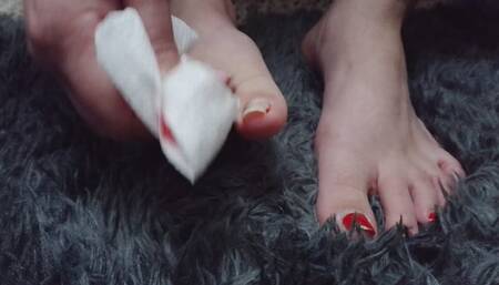 Fixing up broken toenails