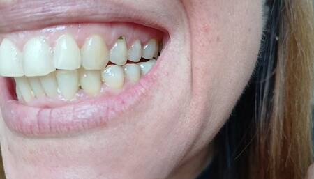 Lania shows her dirty teeth and chooses you to be eaten next