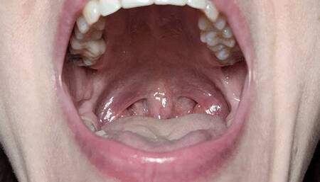 Mouth, tongue and uvula movements closeup 2 T