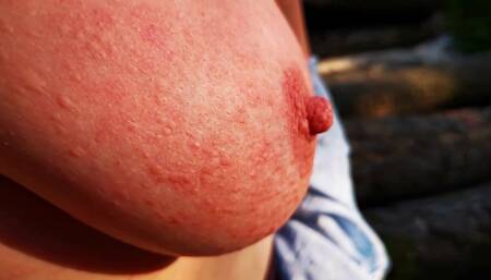 Nettle Punishment Day - Ass, Tits and Vagina in Outdoors - Dc