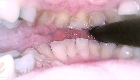 Mouth Cam - Rachel Adams - 1080 2nd