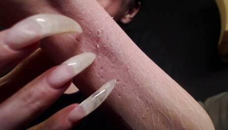 scratching tests nov 2024