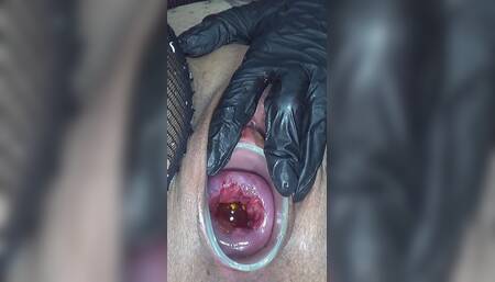Cervix Check