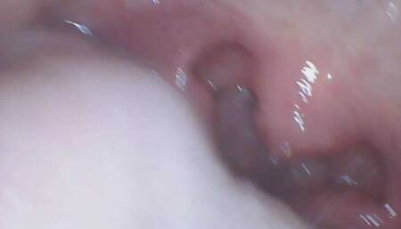 Haley Endoscope Tour and a Snack