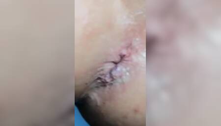 Hole Close up