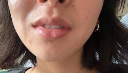 Aurora’s Teeth Get A New Look