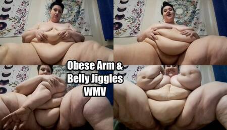 Obese Arm & Belly Jiggles (WMV)