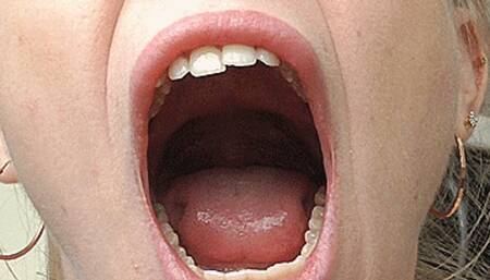 Wide yawning mouth! MP4