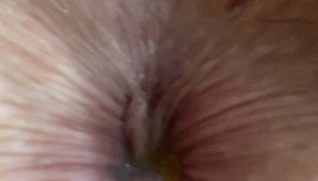 Day 30 of 30 Straight Days of ANAL - Bonnie's ASSHOLE DESTROYED WHILE SHE'S STRAPPED IN GYNO CHAIR POV