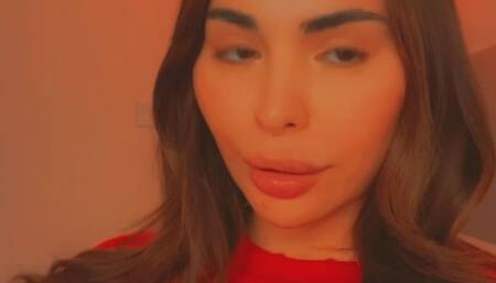 LIP FILLER AND CHEEK FILLER BIMBO TRANSFORMATION