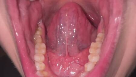 Swallowing Pickles Whole