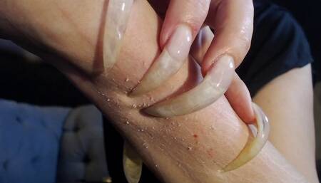 scratching test jan 2025