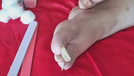 Cleaning the Crust out of my Toenails