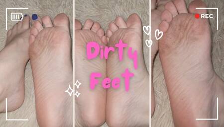 Dirty feet