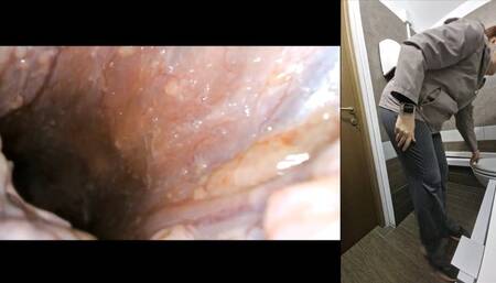 An Unexpected Exploration: Ingesting a PillCam for a Fascinating Journey Through My Own Anatomy 720HD